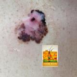 Дерматология. Полезное - Telegram канал