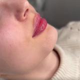 КОСМЕТОЛОГИЯ КРАСНОДАР | ОБУЧЕНИЕ — Telegram канал